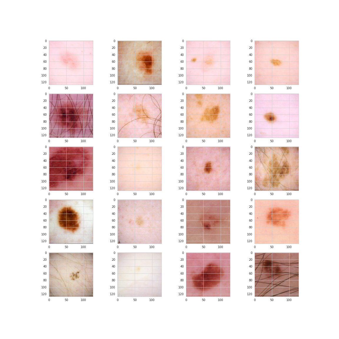 Twenty random images of benign lesions.